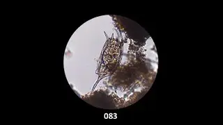Keratella: The Spiny Rotifer
