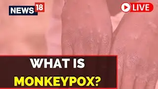 Monkeypox News Live | India Monkeypox Cases | WHO | Live News | Latest News | English News Live