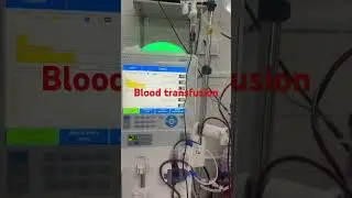 Blood transfusion procedure | blood transfusion kaise karte hai #bloodtransfusion #dialysis #shorts