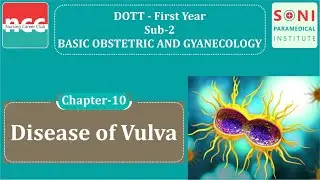 DOTT 1.2.10 - Disease of vulva