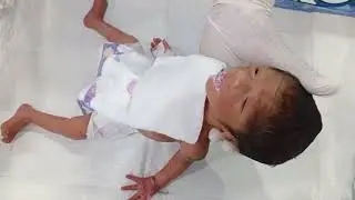 Part 2. Preterm Baby First Bottle Feeding Trial  NICU Care & Initial Assessment
