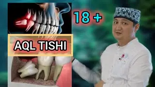 акл тиши йоки аклсиз тиш хакида ешитганмисиз?