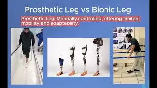 Futuristic Bionic Leg: Empowering Amputees with Advanced Mobility Solutions