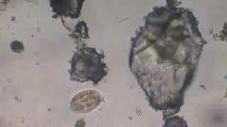 Protozoon, ciliate
