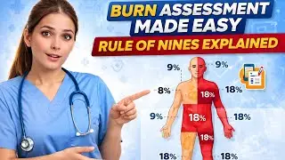 Burn Assessment Made Easy: Rule of Nines Explained