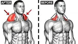 The ONLY Trap Workout You&rsquo;ll Ever Need (Bigger Traps in Weeks!)