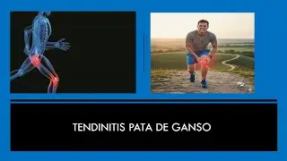 TENDINITIS PATA DE GANSO
