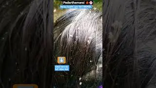 Padarthamarai 🍁🌸 #shorts #viral #trending #health #ringworm #skin #skincare #itching #oil  #tamil