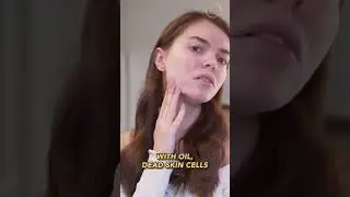 Это вросший волос или прыщ?