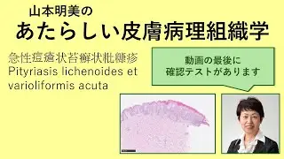 あたらしい皮膚病理組織学　急性痘瘡状苔癬状粃糠疹 Pityriasis lichenoides et varioliformis acuta