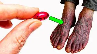 THE #1 VITAMIN to ELIMINATE POOR CIRCULATION in the LEGS AND FEET (Cheap and easy to find) | 530