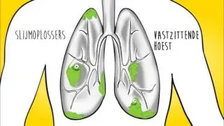Bisolvon 2 soorten hoest &ndash; welke soort hoest heb ik?