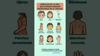 Se&ntilde;ales en la piel que pueden indicar problemas en el h&iacute;gado