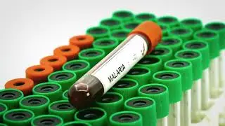 Marut ZAP- India&rsquo;s first vector borne disease platform - Dengue/Malaria -Predict, Detect & Control