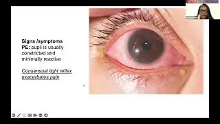 Dr. Ebhohimen - Small Talks - Approach to the Nontraumatic Red Eye