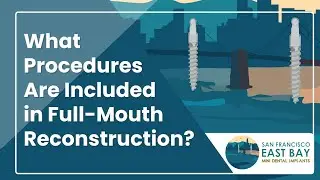 What is Included in Full Mouth Reconstruction? | Dr. Rose Magno #fullmouthrestoration #miniimplants