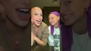The baldie brows🤝 alopecia #browtutorial #eyebrows #makeup #alopecia #alopeciaawareness
