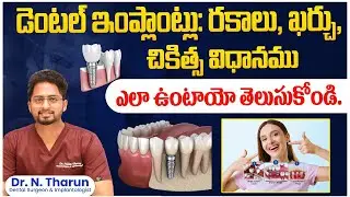 Types and Cost of Dental Implants in Telugu | Dental Implant Treatment Process | Eledent Dental