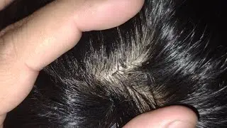 500$ High pressure head massage ASMR Relaxing and sleeping part 50 😴😪