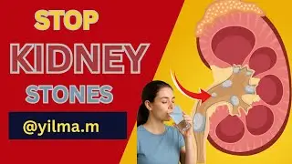 Kidney Stones Warning Signs You Should Never Ignore/@Yilma.M