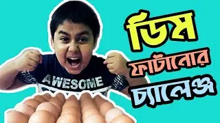 Egg Break Challenge Between Brothers | ডিম ফাটানোর চ্যালেঞ্জ । Bro vs Bro | ZabirBro Officials
