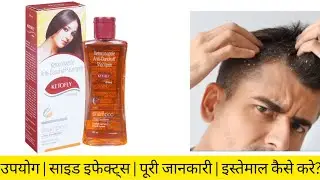 Ketofly Shampoo | Dandruff & Fungal Scalp Infection Treatment | Ketofly Shampoo Benefits