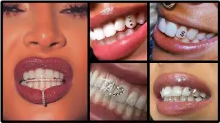 Unbelievable, Stunning Tooth Jewelry || Get A Sparking Smile || teeth gems