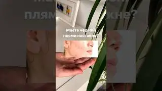 Маєте плями постакне? Тоді ви точно маєте спробувати дует від SkinTra🫶🏼 #cosibella #skincare