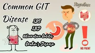 COMMON GIT DISEASE||IBS IBD Ulcerative Colitis Crohn's Disease||RognidanPaper2|| Bams Morden disease