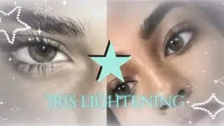 432 Hz | 𝓲ris 𝓵ighting procedure 💉⋆ ୨୧  EMERGENCY subliminal results 🩶