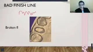 problems between lab and dentist and solutions(short margin) dr Ahmed Reda.   exocad