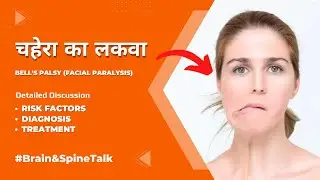 Bell's Palsy (Facial Paralysis), Symptoms, Diagnosis and treatment- Dr Surendra Gupta