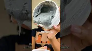 Отзыв о средстве для восстановления кожи головы Briogeo Scalp Revival Charcoal&hellip; стоит ли оно того...