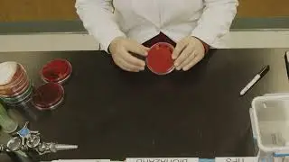 Blood agar plates and hemolysis explained