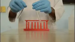 Fehling's Test for Reducing Sugars