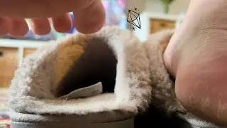 Foot Watch 👀 slippers and cracked heels