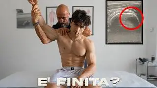 MI SONO INFORTUNATO A 10 GIORNI DALLA GARA