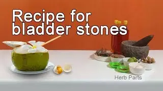 How to cure bladder stones #HerbRemedy
