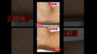 BEST Skincare for CREPEY Body Skin! #skincare #over40skincare  #crepeyskinfix