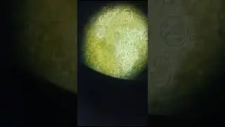 coccidia (Sporulated Oocyst) With movement of merozoites