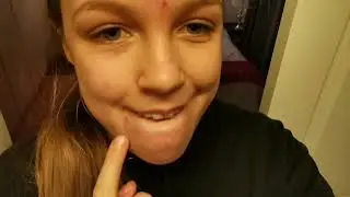 Trying those hydro accne patches | Vlune day 2 | Arwen Weich
