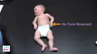 Learn to Spot the Warning Signs of SMA &ndash; Squirming? (Video 7)
