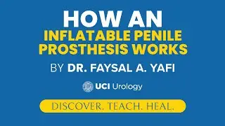 How an Inflatable Penile Prosthesis Works by Dr. Faysal A. Yafi - UCI Men's Health Center
