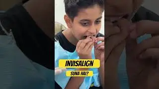 Braces Alternatives: A Guide to Invisalign for Kids