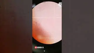 RBC under Microscope| Red Blood Cells