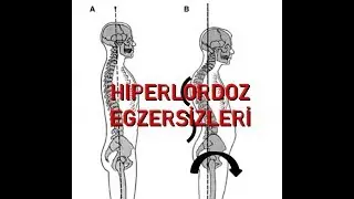 HİPERLORDOZ EGZERSİZLERİ