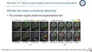 MICCAI 2020 paper:  Uncertainty-Guided Efficient Interactive Refinement of Fetal Brain Segmentation