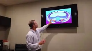 Brett Winchester + Annie O&rsquo;Connor: Integration of DNS + Pain Classification
