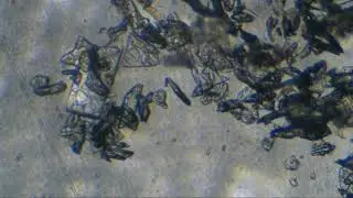 Проба 29. Seilwurm mit D Aspartic acid. Самый ценный тест на мой взгляд