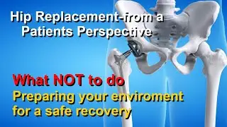 Hip Replacement-from a patients perspective